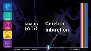 Knowledge Bytes: Cerebral Infarct