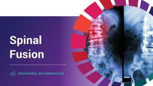 Procedural Documentation: Spinal Fusion